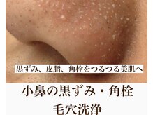 アンテイン チル(anthein chill)の雰囲気（肌になるべく刺激をいれない手法で、確実に毛穴レスに導きます）
