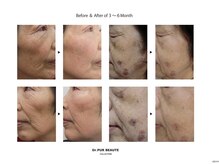 セレーノ 白金台(seReno)/「隠すから魅せる肌へ」