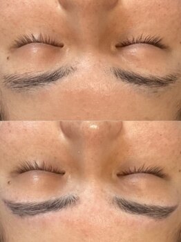 ビトタン 倉敷本店(+美to鍛)の写真/【眉毛×美肌ケアで印象チェンジ☆】初めてでも安心！骨格似合わせ美眉アイブロウやハーブピーリングが◎