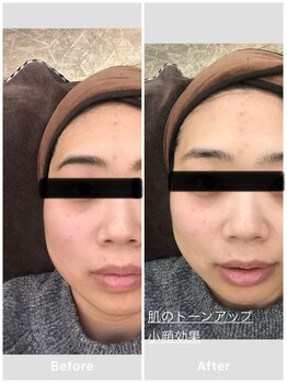 ミロク 伏見桃山店(miroku)/