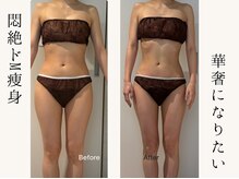 アンパウマン(Anpawman)/悶絶ドМ痩身5回　症例