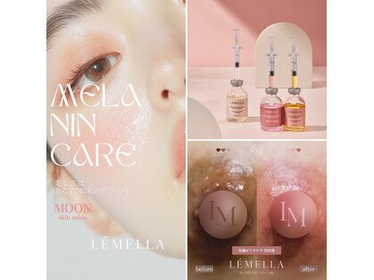 ムーニ(MOONI)の写真