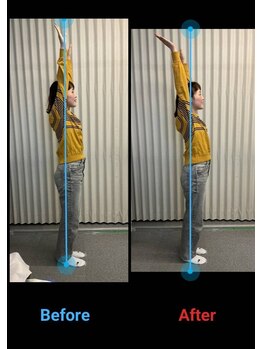 りらく整体 あおば/巻き肩も肩の挙上制限の原因