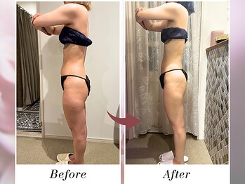 リボーン(boju reborn)/◆30代のお客様◆