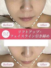 リフト 布施(Lift)&nbsp;理想の Ｖライン