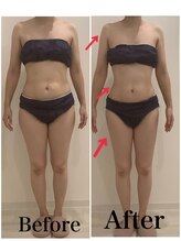 スペチアーレ 夙川/脂肪撃破