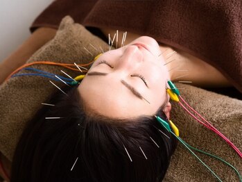 ワームリー 久留米(warmly)の写真/【圧倒的高い技術力◎】人気No,1（顔・頭）電気美容鍼＋ヘッドマッサージ60分￥6,600/疲労を一気に解消◎