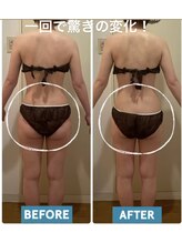 ヨサパーク レナータ(YOSA PARK Renata)/30代【痩身】一度で驚きの変化！