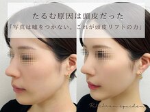 プルチャームエクイデム(Pulchram equidem)