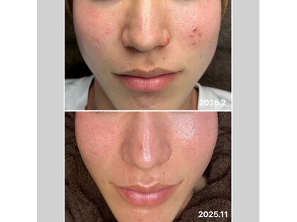 ヴィヴ フォー アール(VIV for R)の写真