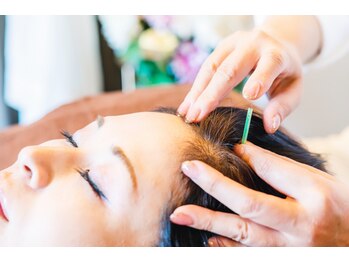 ハリキュア(Hari-Cure)の写真/女性のお悩みに寄り添う育毛鍼！頭皮ケアで毛穴から丈夫な毛を育て、血流改善をサポート◎