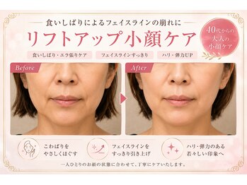 ラシクビューティールームの写真/食いしばり・顎下・フェイスラインが気になる方へ。大人の小顔ケア