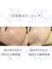 【2回目以降】【肌質管理】カスタマイズ肌質管理(肌診断込)