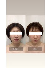 パラフューズ 札幌店 ブランジュ(PARAFUSE.)/脳洗浄before after