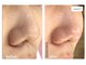 ビューティーサロンエイト(Beauty Salon8)の写真