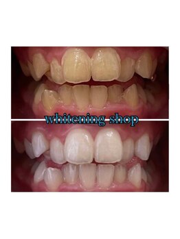 ホワイトニングショップ 所沢店/ホワイトニングショップ所沢店