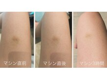 ナチュラルメソッド(Natural Method)/細胞活性で本来の白さへ◎