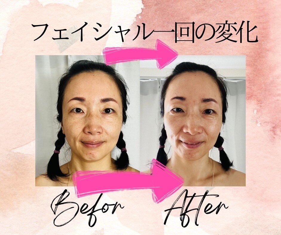 肌質改善エステサロン♡ 岡山エステ/岡山肌質改善_完全予約制🌡️お肌の救済所🏥𝐁𝐚𝐛𝐲