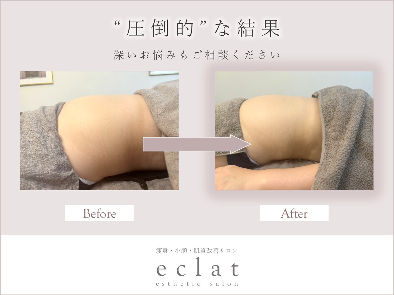 エクラ 五反田(eclat)｜ホットペッパービューティー