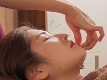 リアン(LieN)の雰囲気(身体の内側からアプローチ!様々なお顔や身体の不調を改善◎)