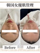 ドレス(dress)/韓国肌管理「童顔プログラム」