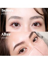 アリイ(ALII)/眉毛のレスキュー