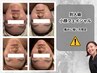 【小顔フェイシャル】多少の痛みOKな方限定★写真撮影、アンケート記入必須★
