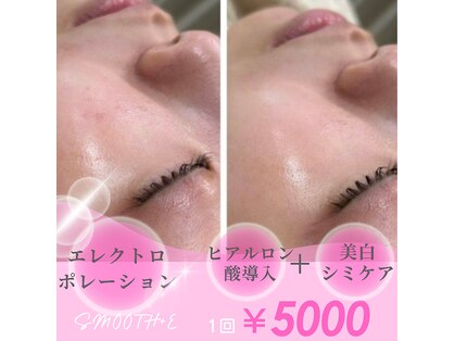 スムース イー(Smooth+E)の写真
