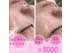 スムース イー(Smooth+E)の写真