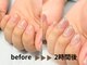 ナチュリア(Natulea)の写真/深爪でもOK！浮かない長持ち長さだし☆今日から見た目を変えられる♪ご旅行デート参観日などのイベントに