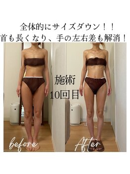 ラルーエ 仙台/施術10回の変化