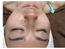 ムーン(Moon)/フェイシャルエステ