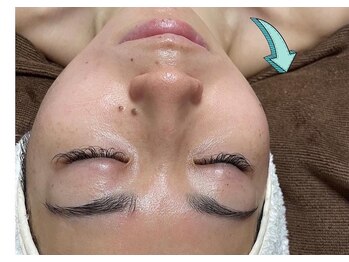 ムーン(Moon)/フェイシャルエステ