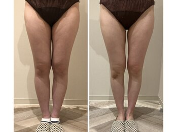 エイシスグロウ(asis glow.)/効果写真