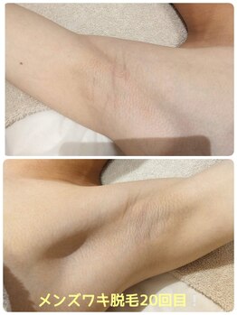 エピット ウイングベイ小樽店(epitto)/