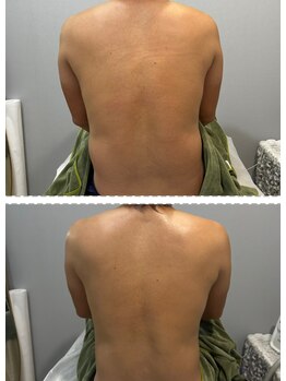 ラヴィエール(Laviere)/揉みほぐしリンパマッサージ