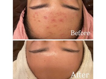 ナルシス(Narcissus)