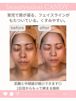 ビューティーサロン キャンディ 海老名(Candy)/
