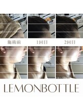 ベイジョ デ アンジョ(Beijo de anjo)/レモンボトル