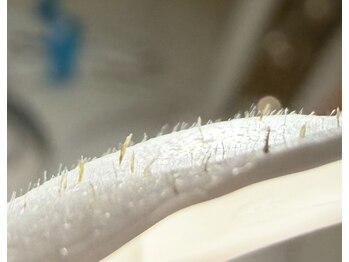 ビキャット(Be cat)/フェイシャルワックス脱毛