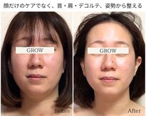 グロウ バイ フェイシャルデザイン アンド アイ(GROW)
