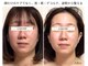 グロウ バイ フェイシャルデザイン アンド アイ(GROW)の写真