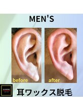 ビー ファクトリー(B FACTORY)/メンズ　耳周り