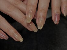 ネイル琴(nail koto.)/