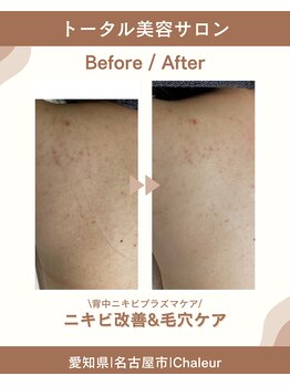 シャルール プラス(Chaleur+)/