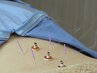 当店人気No.1【お悩みに合わせたオーダーメイド】鍼灸＋整体 60分7500円→