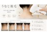 【男性OK】最新美肌高速脱毛　うなじ（剃毛込み）　30min ￥4400
