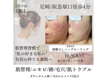 アミーカリーナ 阪急塚口店(Amicarina)の写真