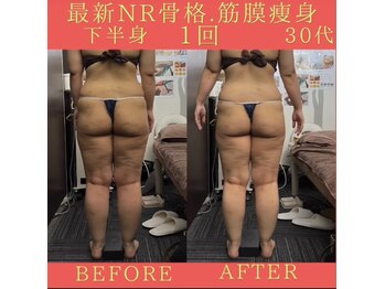 リラクゼーションサロン ラキ(laki)/NR筋膜骨格調整1回