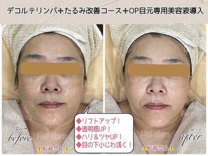 ピエルクララ(Piel clara)の写真